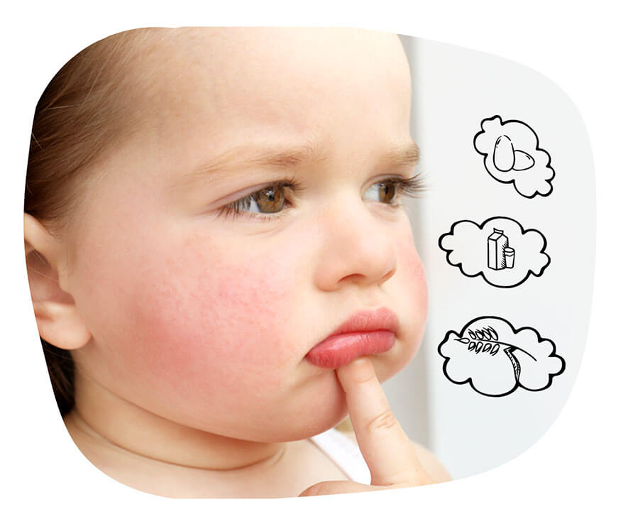 Alergia Pokarmowa U Dziecka Rozpoznanie I Leczenie Emotopic